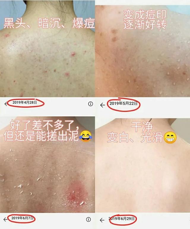 洗澡搓出来的泥每天都可以洗,洗澡搓出来的泥增多了