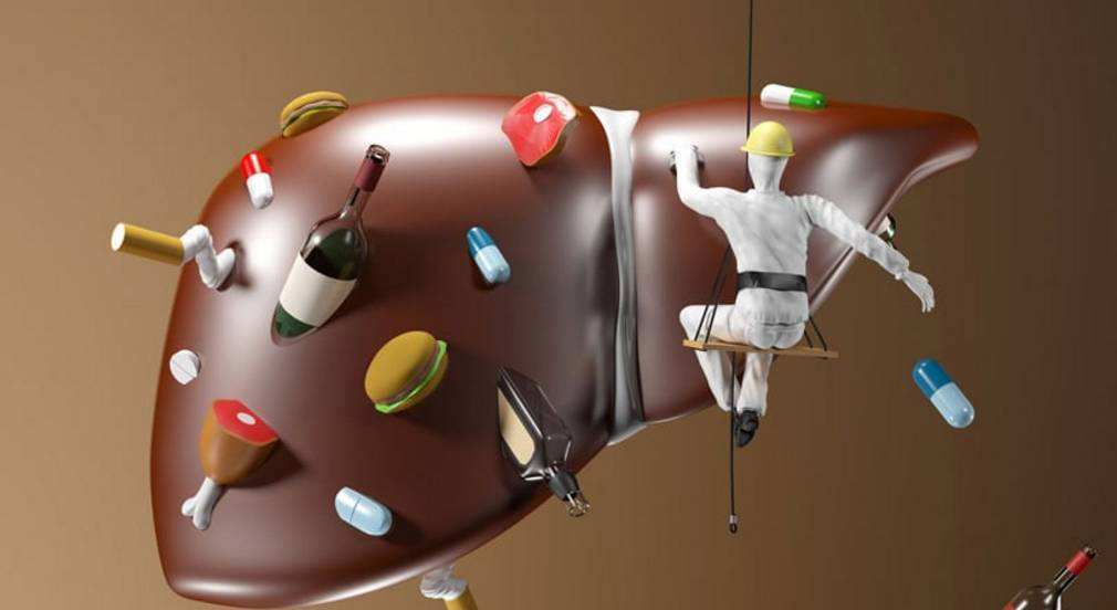 酒精性肝病的定义及发病机制,酒精性肝病和酒精性肝硬化