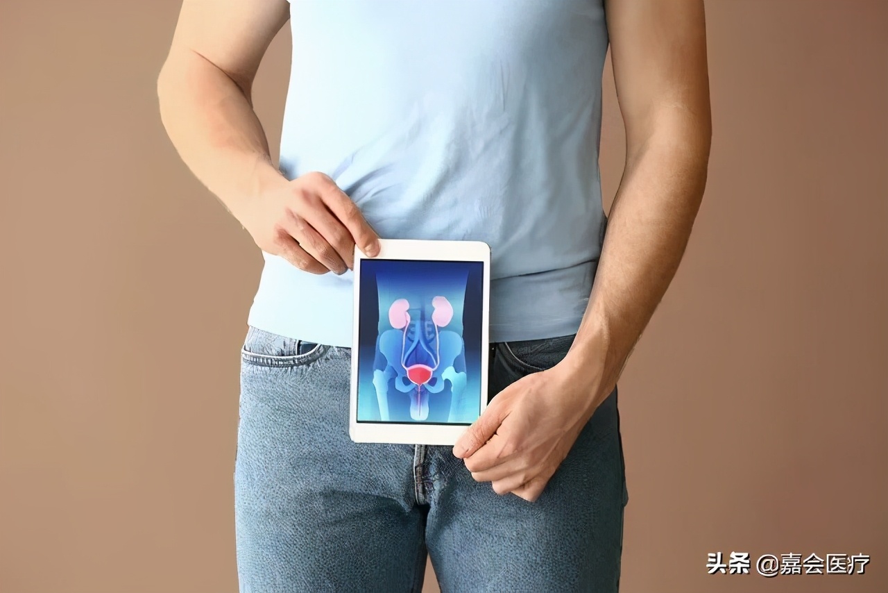 尿出橙色的尿是什么病,尿出的尿是荧光绿色是怎么回事