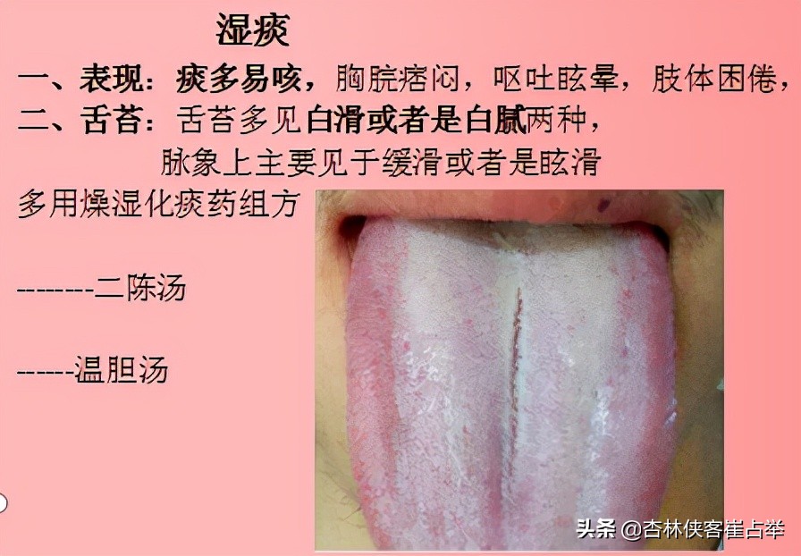 痰在肺则咳痰在胃则呕的意思,肺痰与胃痰