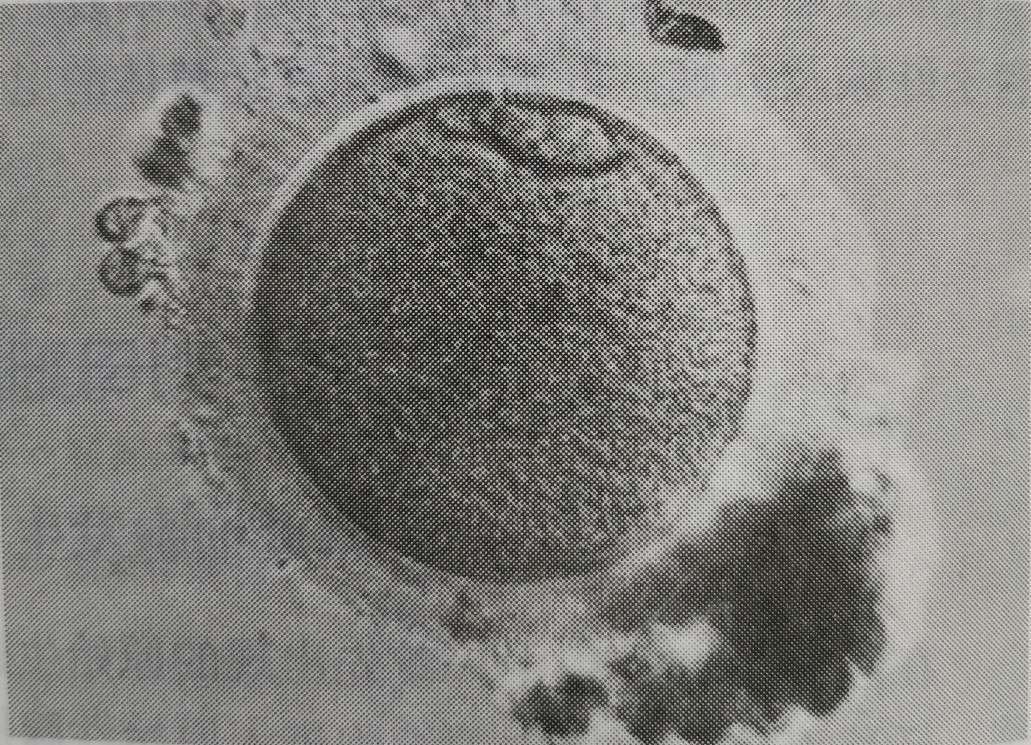 初级卵泡的结构图,现实中卵泡一般什么形状