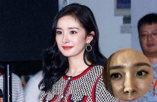 混油痘用什么卸妆品好,皮肤出油长痘严重如何改善