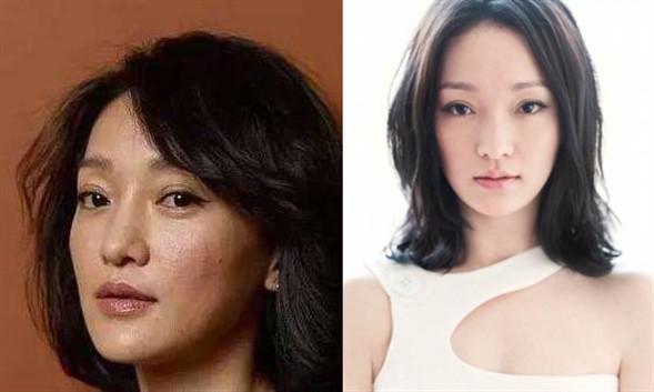 女子为变美花掉300余万后续,女子为变美脸塌陷