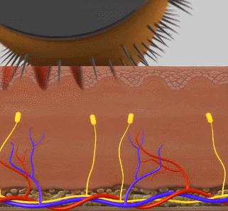昕芙丽胶原蛋白微针效果如何,昕芙丽微针原液