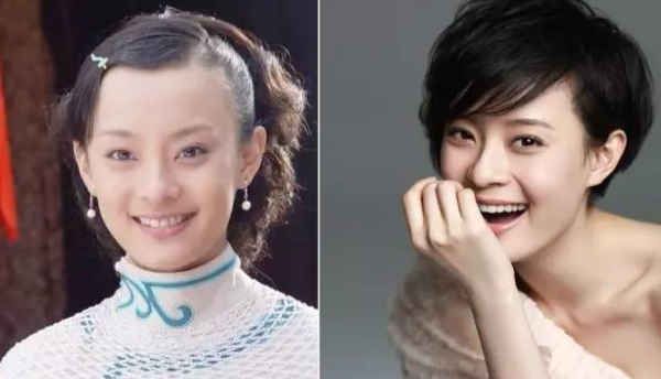 杨幂的高发际线,发际线秃的杨幂