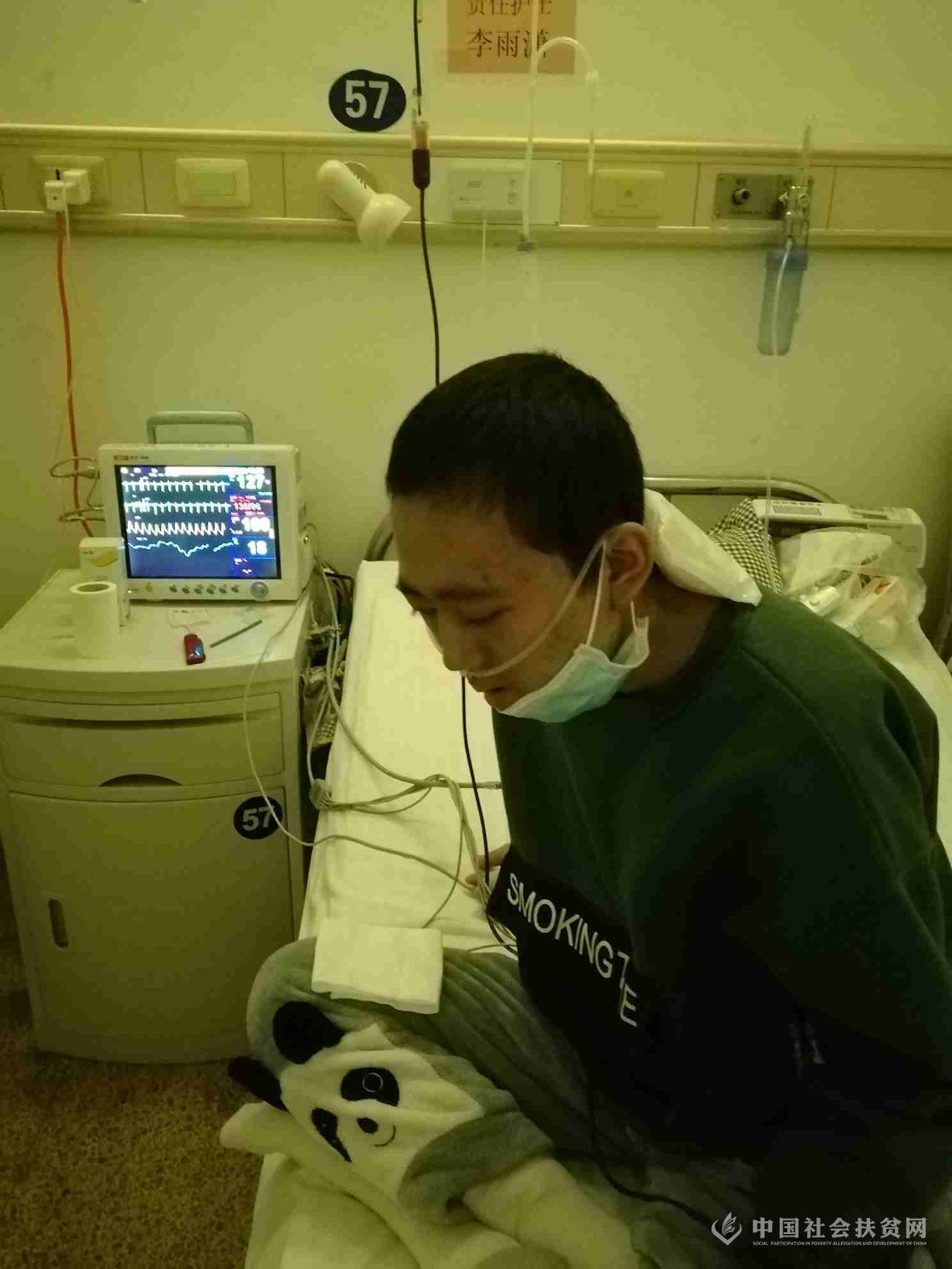 骨髓异体移植全相合排异吗,骨髓全相合移植后会排异吗