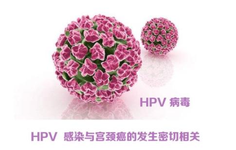 查了宫颈癌怎么看结果,怎么才能看懂宫颈癌筛查报告