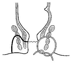 肛瘘手术比生孩子还疼吗,肛瘘手术疼痛可以承受吗