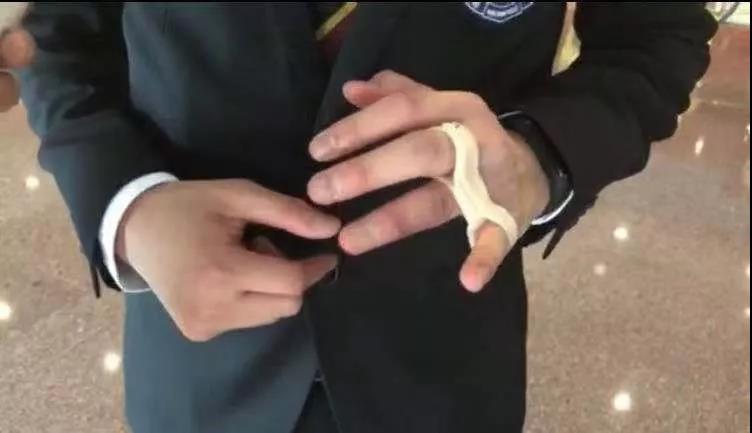 港警中箭,中箭蓝衣