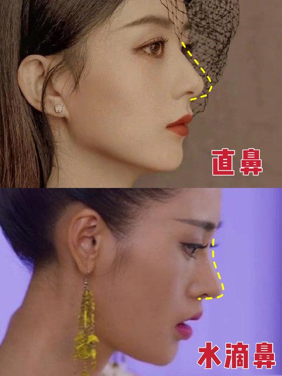 好看的鼻子类型驼峰鼻,好看的鼻型有哪几种