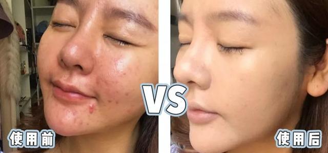 张韶涵护肤全部产品,张韶涵海蓝之谜