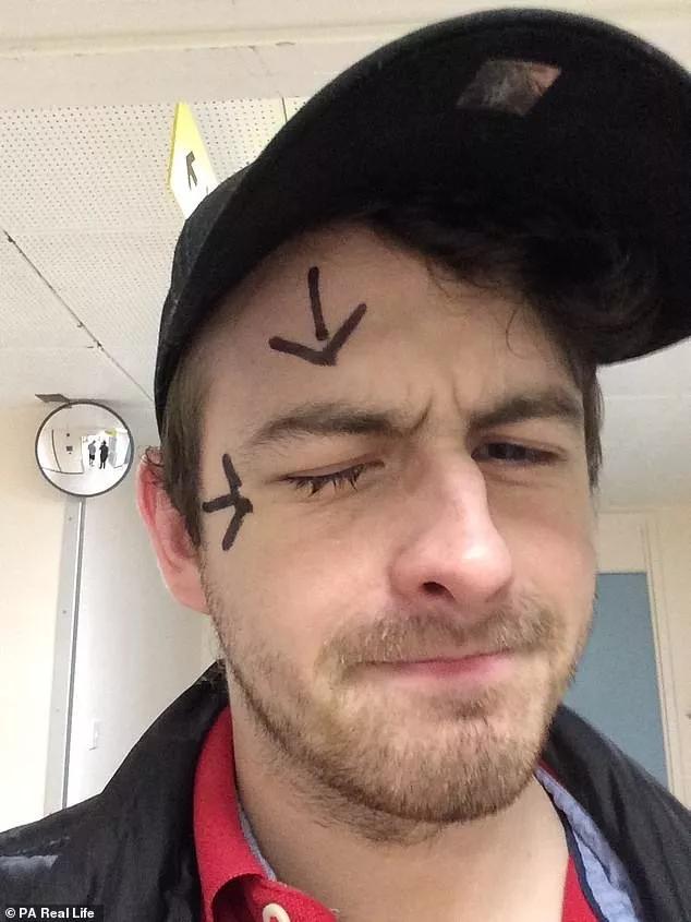 戴隐形眼镜眼睛有虫,戴隐形眼镜眼睛里长虫子