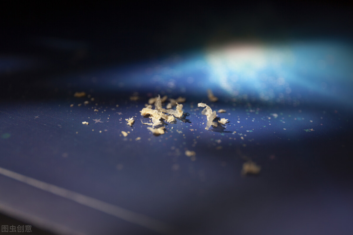 耳屎用显微镜放大是什么样,耳屎在显微镜下是不是活的