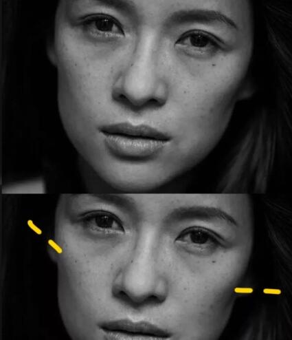 人中长颧骨高适合什么发型,人中长太阳穴凹陷