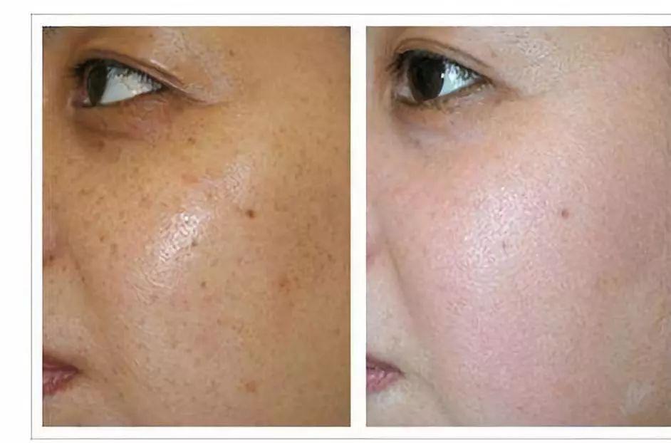 脸部蜡黄暗沉怎么改善,脸上暗沉发黄怎么办还长斑