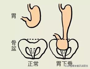 生活习惯造成的消化不良怎么办,生活中哪些习惯会导致胃动力不足