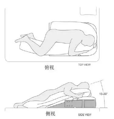 胃食管反流病指南ppt,治疗胃食管反流正确方法