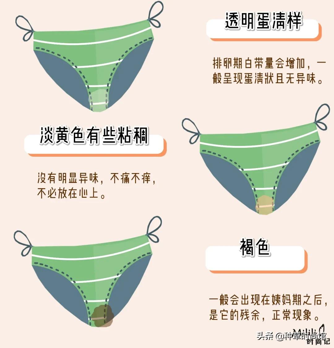 裤底有黄色分泌物,裤上有股腥臭味是怎么了