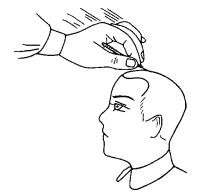 中风后遗症三针疗法,焦顺发靶向定位头针疗法