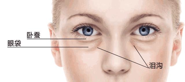 黑眼圈分几种怎么治,黑眼圈的种类和解决办法
