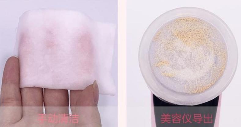 19岁姑娘打溶脂针,女子打美容针脸肿