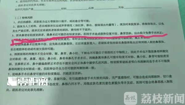 女子整形鼻子歪了失败,鼻子变歪的女人