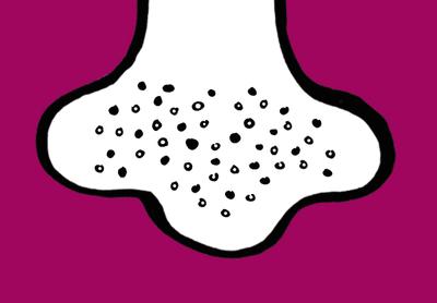 黑头挤到一半挤不出来,黑头挤不完吗