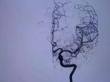 x光b超ct核磁共振区别,收藏这篇就够了