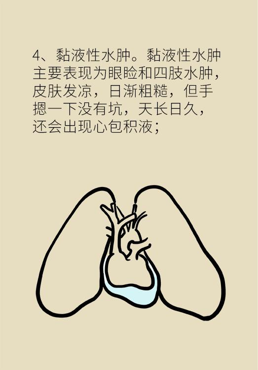 女性经期小腿以下水肿怎么办,起床肿怎么办