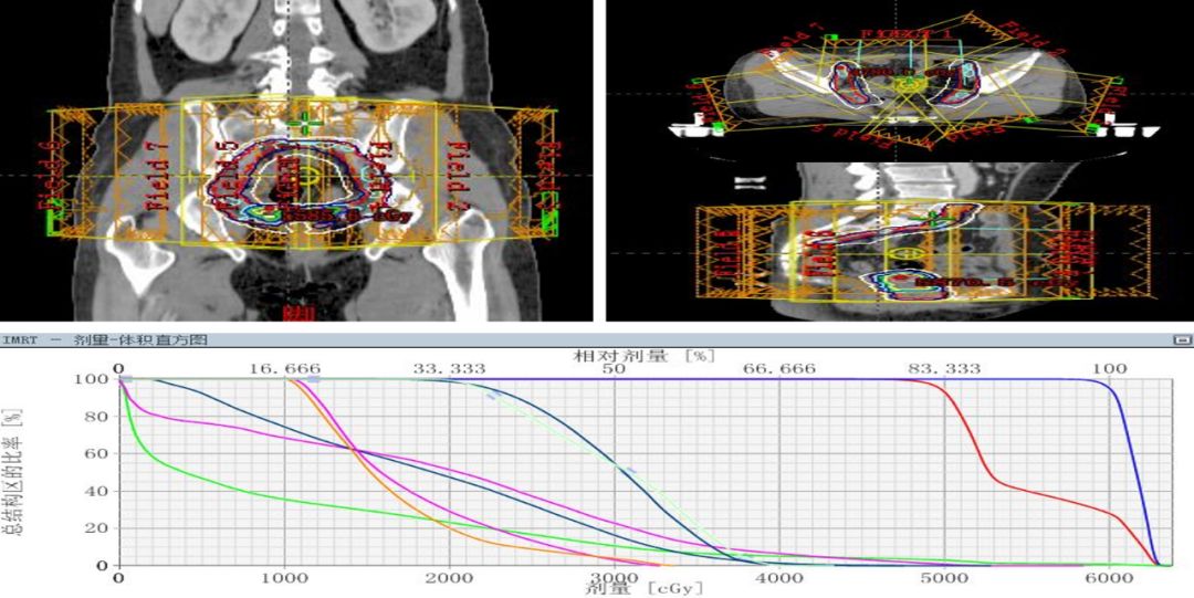 梅艳芳是感染hpv导致宫颈癌的吗,梅艳芳得宫颈癌的原因和治疗方法