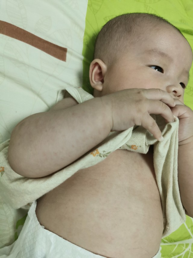 朋友孩子发烧了怎么评论,孩子突然发烧的朋友圈