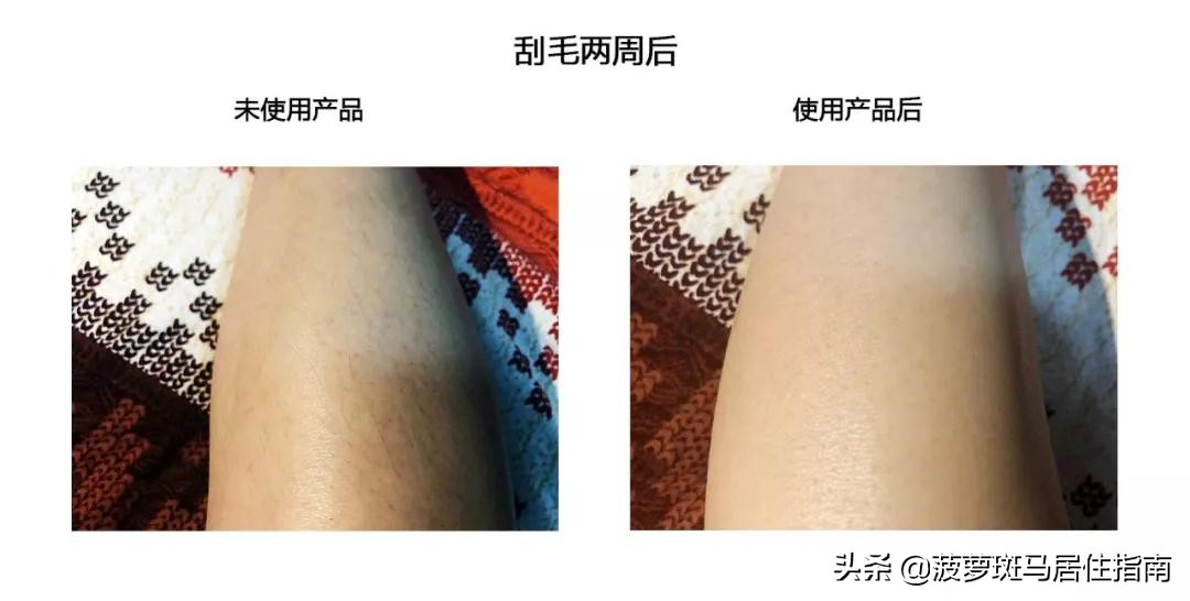 又实用又简单的脱毛办法,脱毛干货