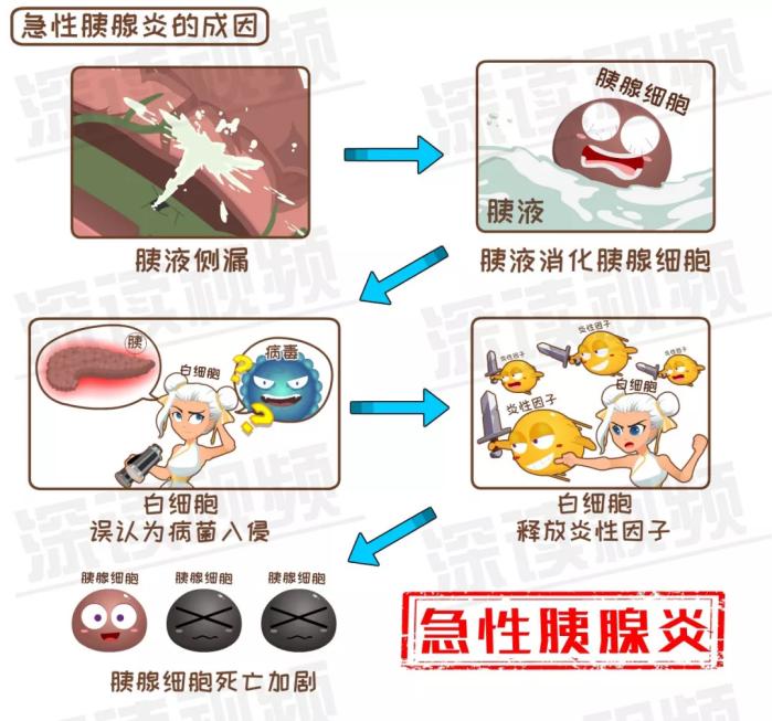 大吃大喝容易引发急性胰腺炎,月子期间胰腺炎是怎么引起的