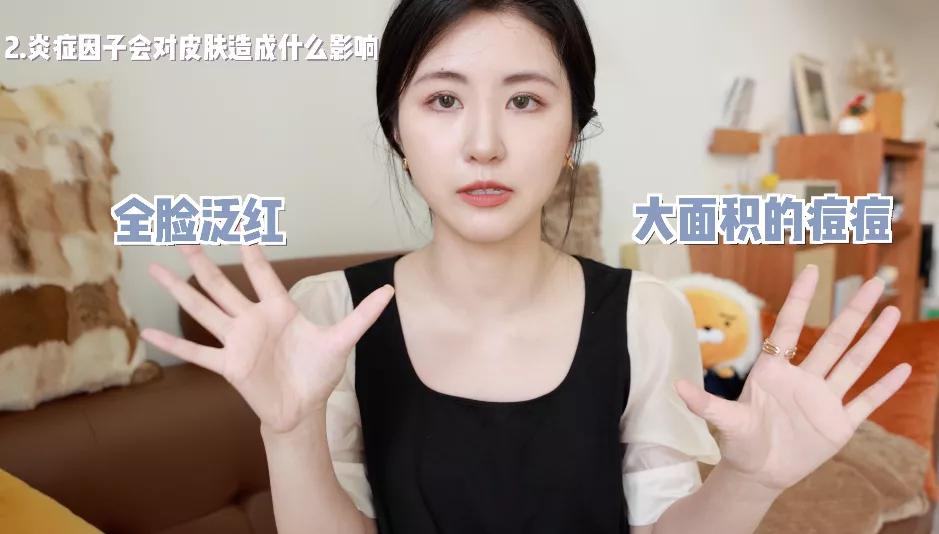 抗炎痘痘,痘痘肌抗炎产品