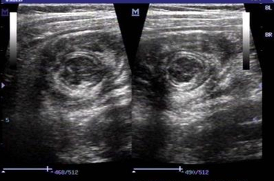 孩子无缘无故哭闹怎么治,孩子突然大哭要警惕