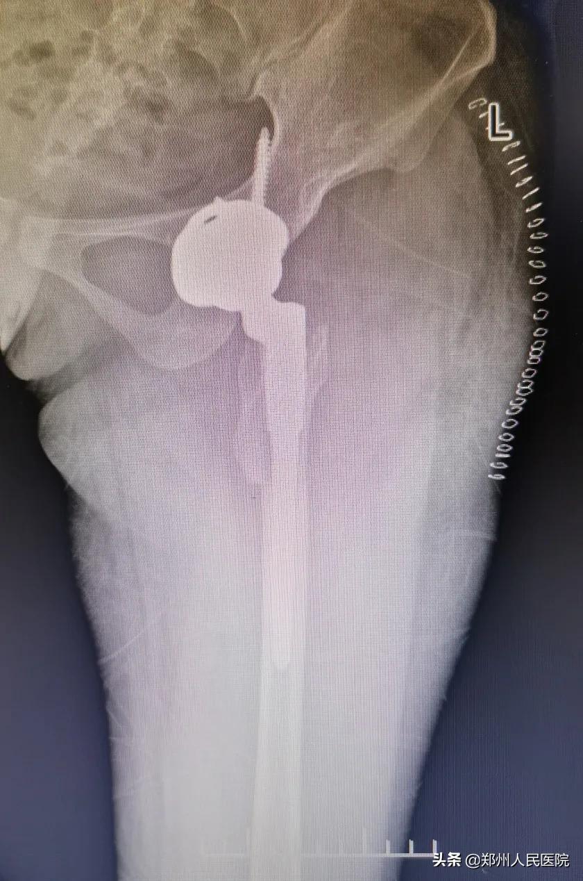 走路像鸭子一样摇摆,走路像鸭子的样子