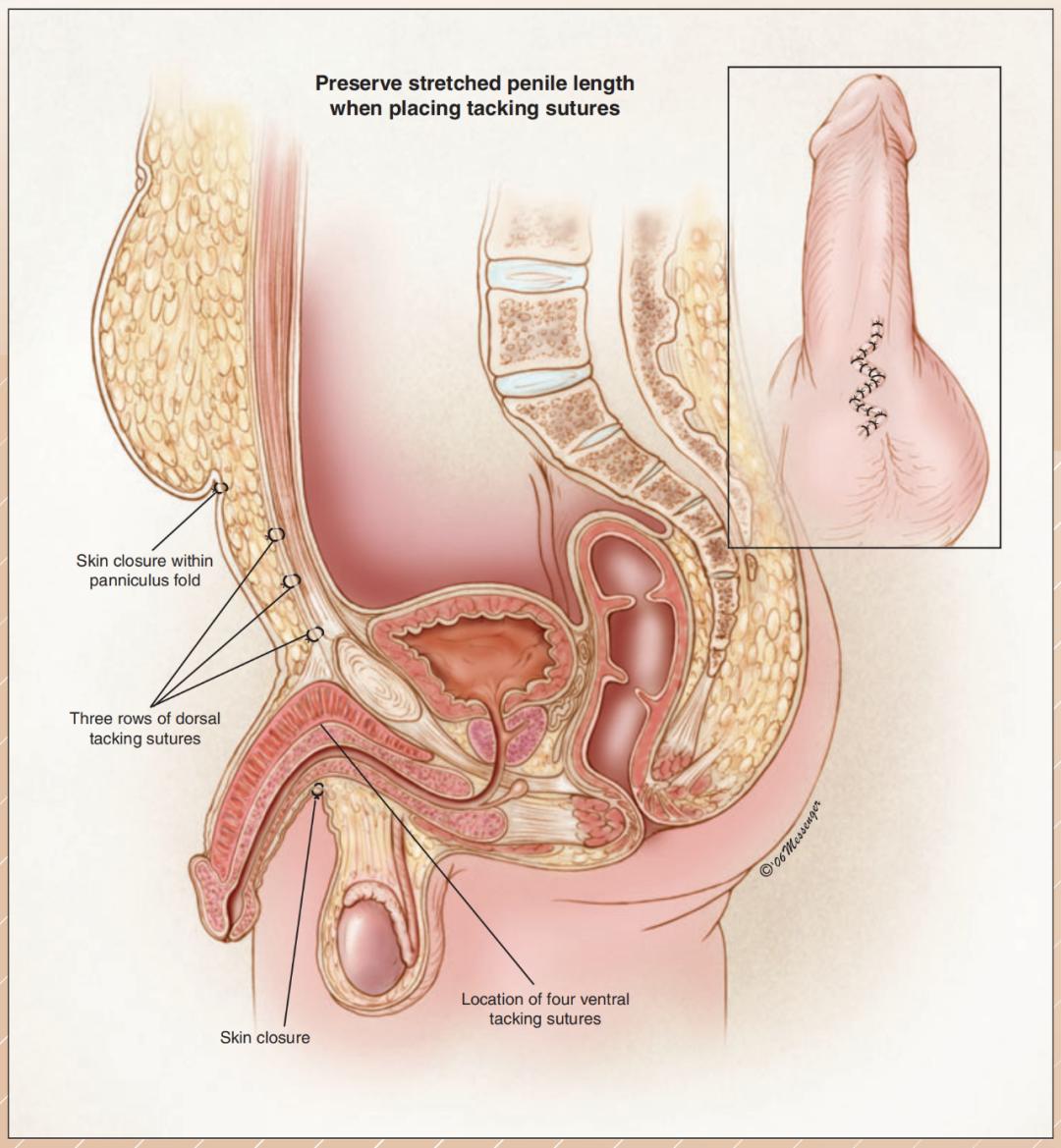 男人越胖能力越差吗,男性一胖胸部就肥大