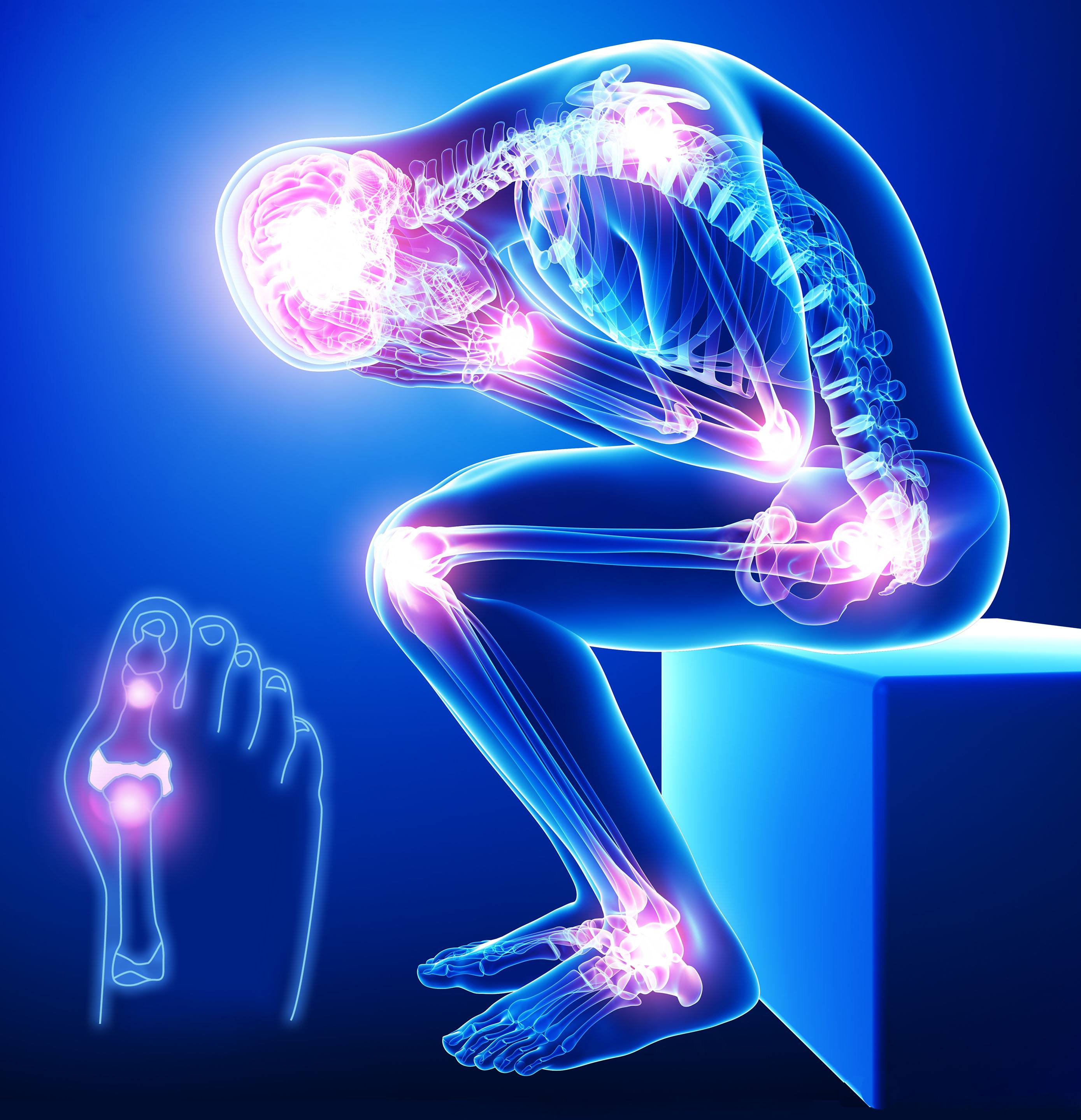 关节炎非甾体类消炎止痛药,非甾体类抗炎止痛药的禁忌