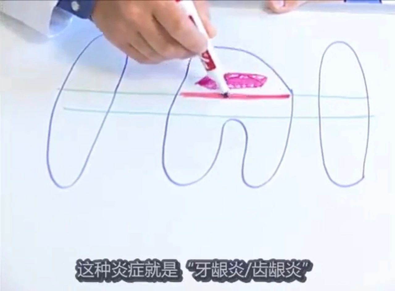 你的猫是否也有一个糟糕的口腔环境？谈谈猫口腔疾病那些事儿