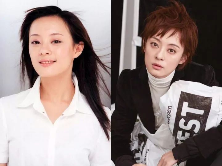 如何改善咬肌鹅蛋脸,咬肌变大脸发腮怎么改善