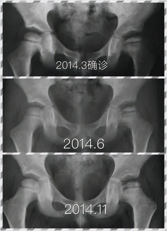 儿童医院儿童骨科,儿童骨科专家讲解