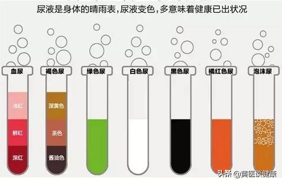 快速看懂尿液检查单