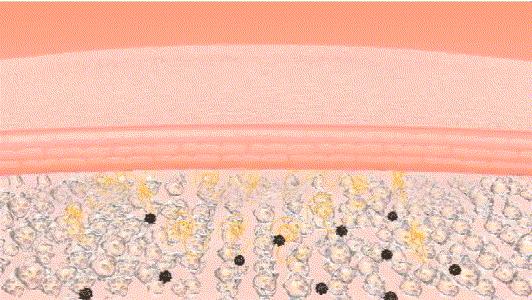 防眼角皱纹最好的方法,眼部皱纹多特别显老