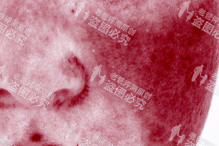 拯救敏感肌的方法,拯救敏感肌的药膏