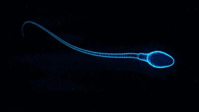 科学家发现精子运动规律,科学家们首次发现精子的运动规律