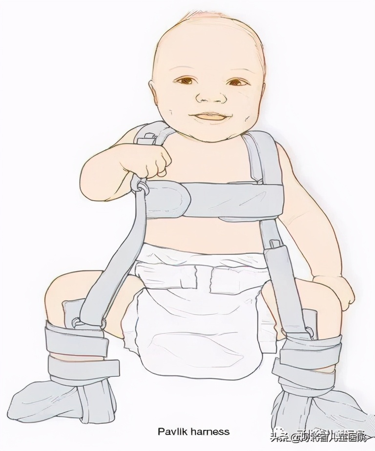 腿纹不对称家长千万别忽视,腿纹深浅不一样算不对称吗