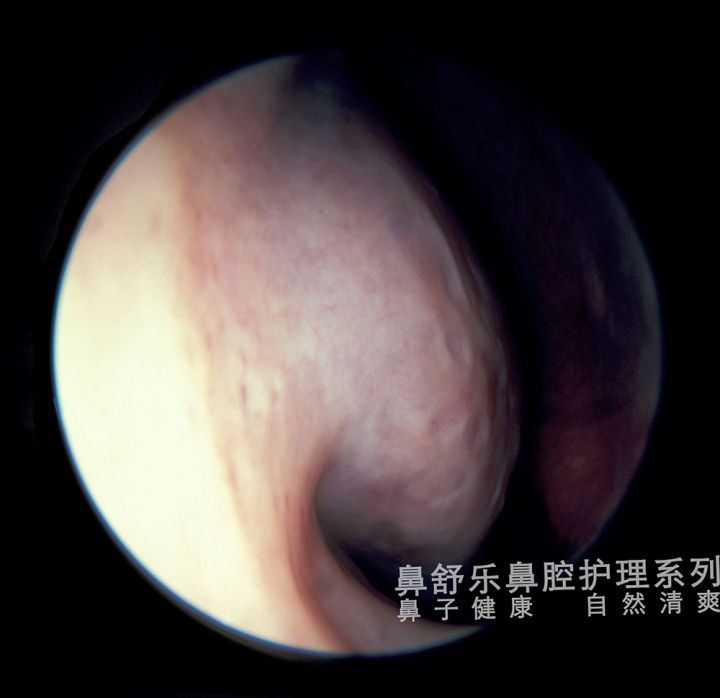 路边的鼻炎馆靠谱吗,路边的鼻炎馆怎么那么贵