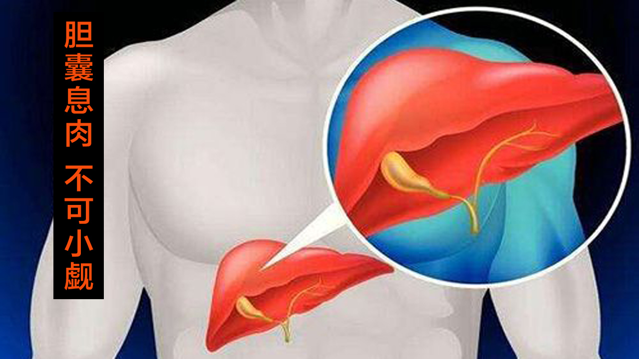 胆囊息肉是很常见的病吗,胆囊息肉9mmx7mm算严重需要手术吗