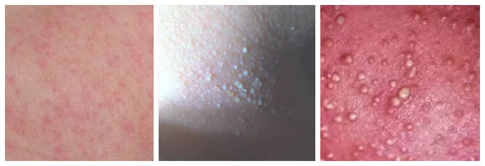 做好三件事宝宝轻松带,夏天宝宝用什么洗澡可以去除痱子