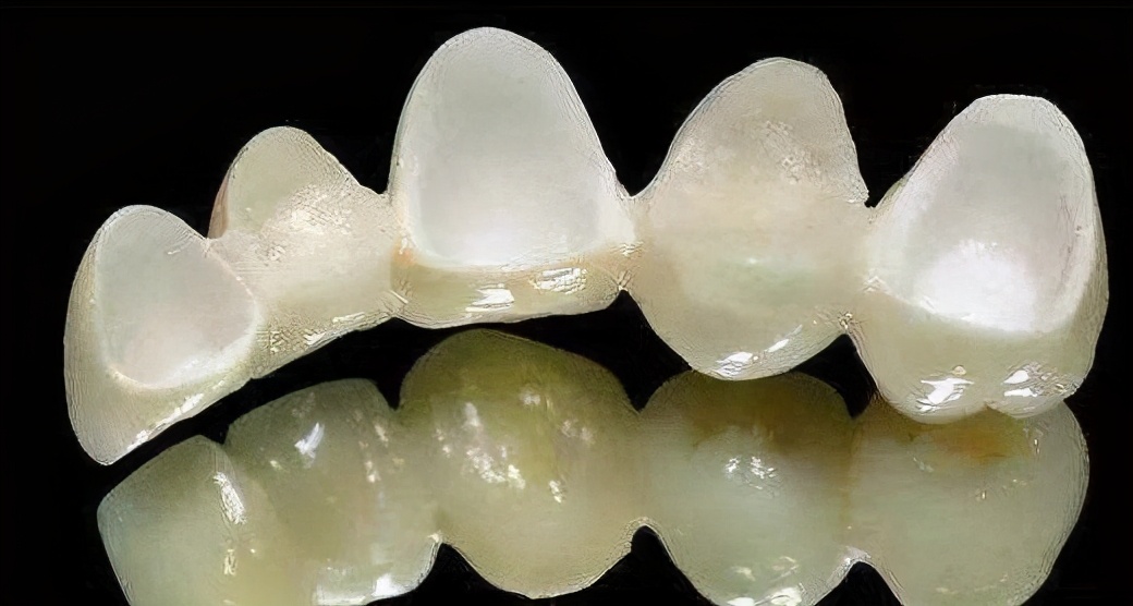 二氧化锆烤瓷牙进口和国产区别,二氧化锆烤瓷门牙缺点